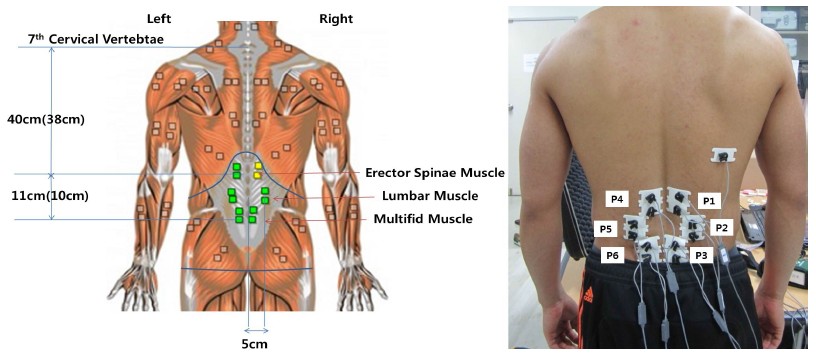 [Figure 1]