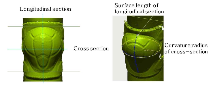 [Figure 2]